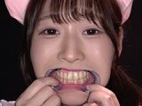 野こはるチャンの舌ベロ・歯・口内・のどちんこ観察
