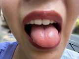 街角で声をかけて口内観察させてもらう さつきちゃん